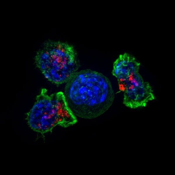 A “stress test” with a previously unknown gene to revive the exhausted T cells