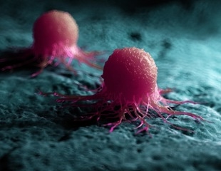 Study insights suggest novel targets for anti-cancer therapies