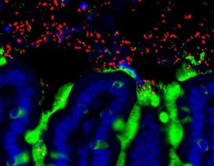Studies highlight bacteria accelerate the leukemia development in mice through specific viruses