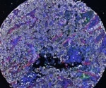 Encouraging breakthroughs in eliminating therapy-resistant cancer cells