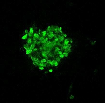 Novel method tags proteins from specific cancer cells