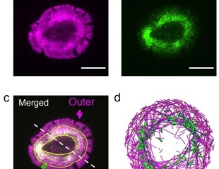 Actin serves as catalyst for shaping the cells