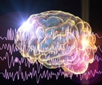 Specific genetic variant resulting in the early onset of epilepsy identified
