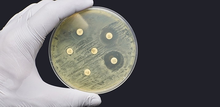 New information to combat the global challenge of AMR
