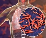 New DNA analysis leads to first accurate tuberculosis genome identification
