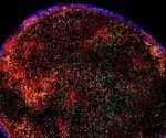 New revelations on the immune system’s defenses against infections