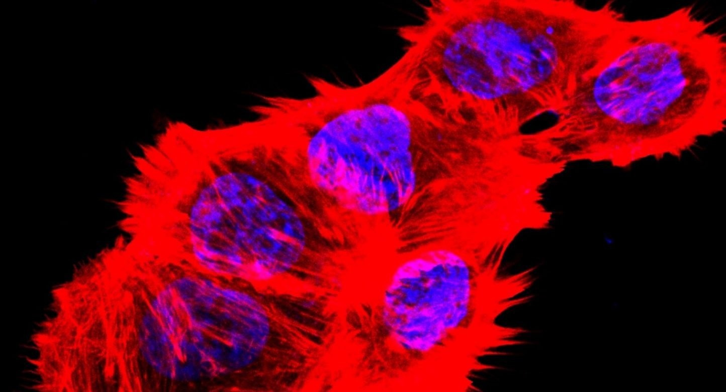 Innovative cancer therapy options with new cell death mechanism