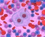 Analyzing the immune microenvironment around Hodgkin lymphoma tumors