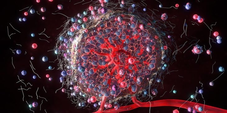 Macrophages likely to be a potential target for ER+ breast cancer