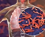 Two types of immune cells interact to give natural protection from tuberculosis