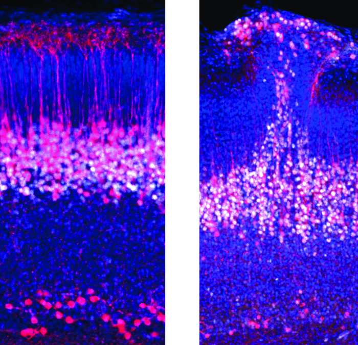 New Embryonic Brain Circuit Offers New Insights on Circuit Abnormalities in Autism