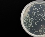 Novel Drug Slows Development of Antibiotic Resistance