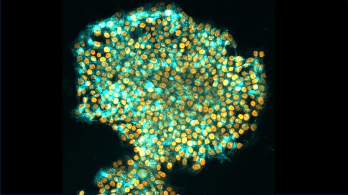 Reprogramming Human Cells to Effectively Mimic Embryonic Stem Cells