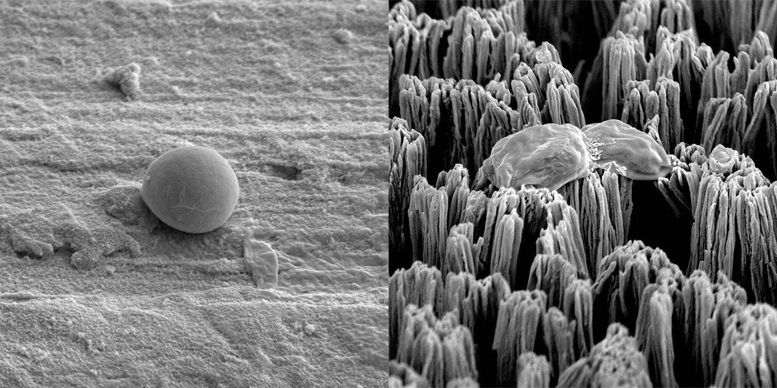 Titanium Micro-Spikes Skewer Resistant Superbugs