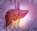 Living Model of Human Liver Offers Help in Combating Liver Diseases