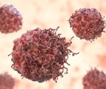 Researchers Target Pancreatic Cancer’s Metabolic Switch