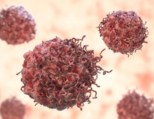 Researchers Target Pancreatic Cancer’s Metabolic Switch