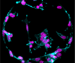 New Insight Into How Cancer Cells Function in Softer Tissue Environments