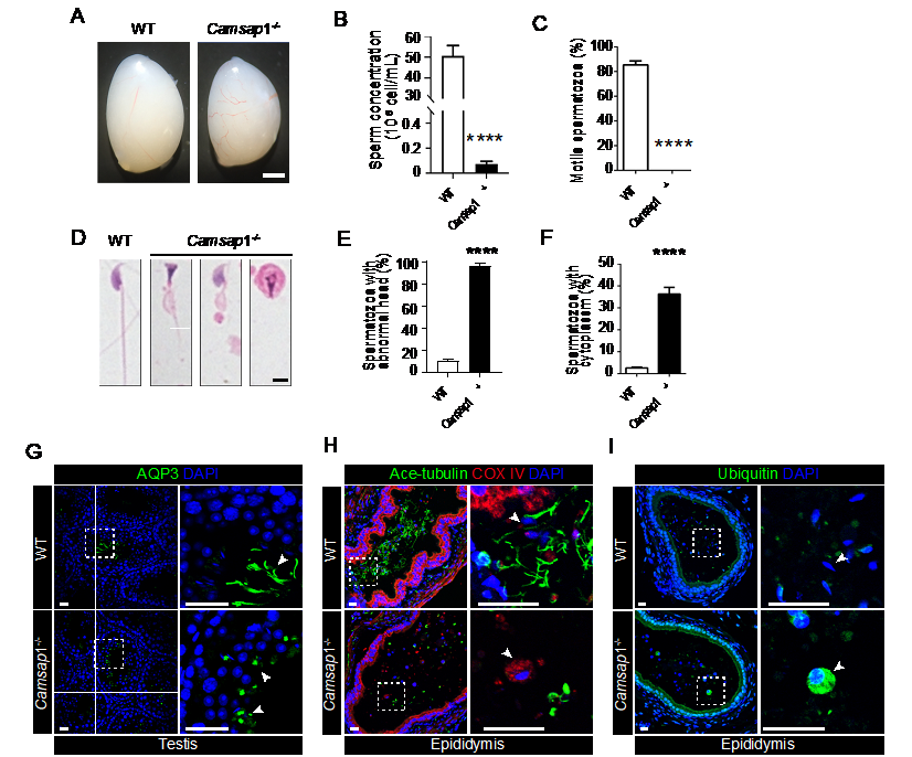 Understanding the Dynamic Regulation of Manchette Microtubules in Sperm Development