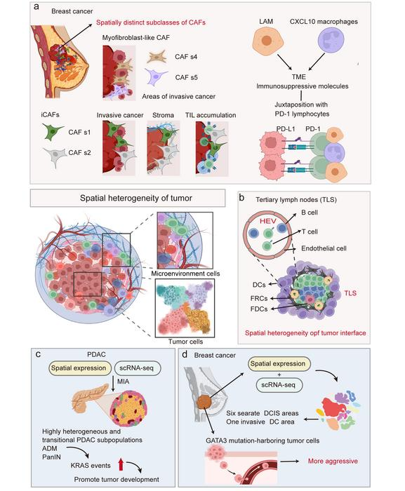 Deciphering the Tumor Microenvironment with Spatial Transcriptomics