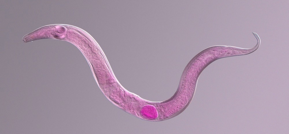 Microscopic photograph of a nematode colored under a phase contrast microscope