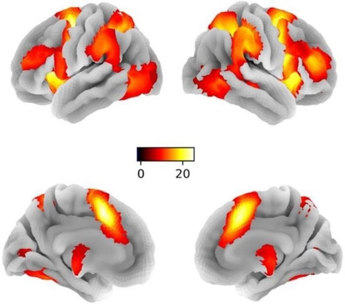Brain Imaging Study Unravels the Secret of Impulse Control