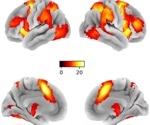 Brain Imaging Study Unravels the Secret of Impulse Control