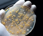 Study Investigates Antibiotic Resistance Genes Transfer Between Bacteria