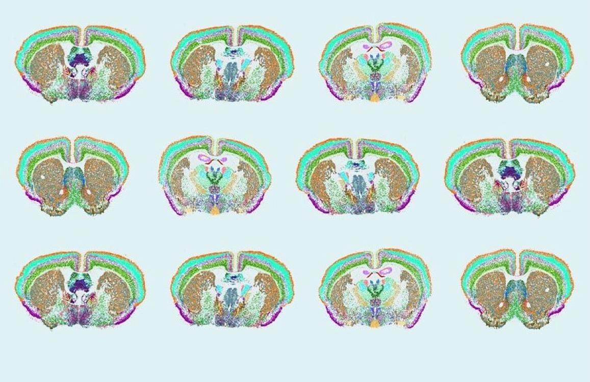 Mouse Brain Atlas Unveils a Molecular Blueprint for Understanding Brain Function