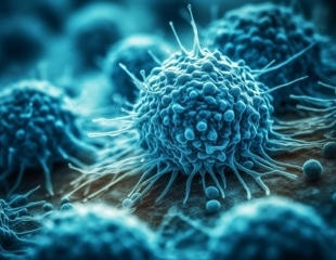 CD4+ T Cells Revealed as Powerful Cancer Killers