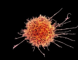 Trapped Inside Tumors: How Dendritic Cells Lose Their Anti-Tumor Abilities