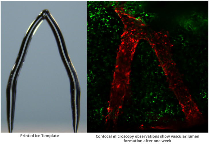 Unlocking the Potential of 3D Ice Printing for Artificial Blood Vessels