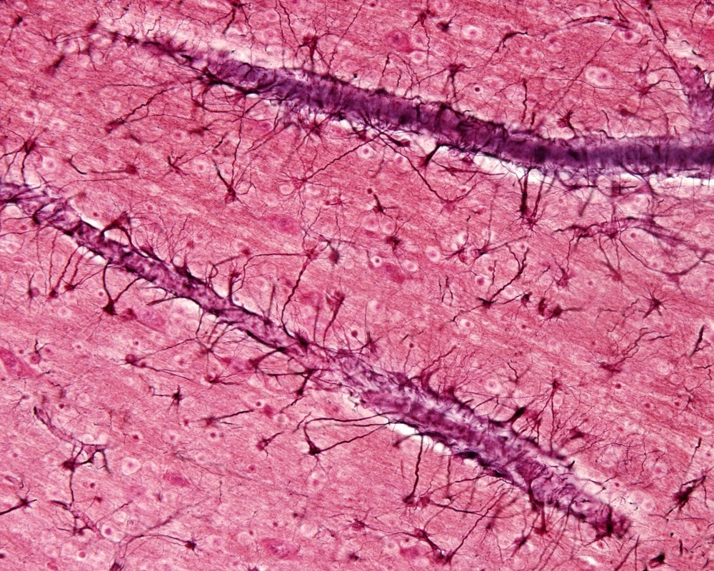 Astrocytes of the brain white matter stained black with the Cajal gold-sublimate method. These cells show long processes that are related to the blood vessels (end-feet or vascular feet).