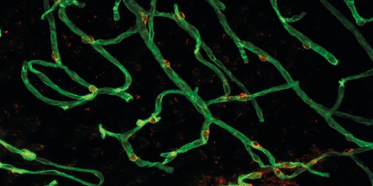 New Study Sheds Light on Blood-Brain Barrier Dysfunction in Aging