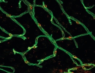 New Study Sheds Light on Blood-Brain Barrier Dysfunction in Aging