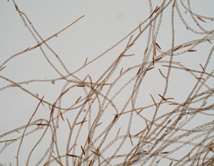 Unraveling the Mysteries of Brown Algae's Sex Chromosomes