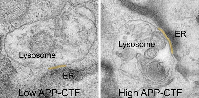 APP-C-Terminal Fragments (APP-CTFs) accumulate between the endoplasmic reticulum and the lysosomes. Image Credit: Vlaams Instituut Voor Biotechnologie.