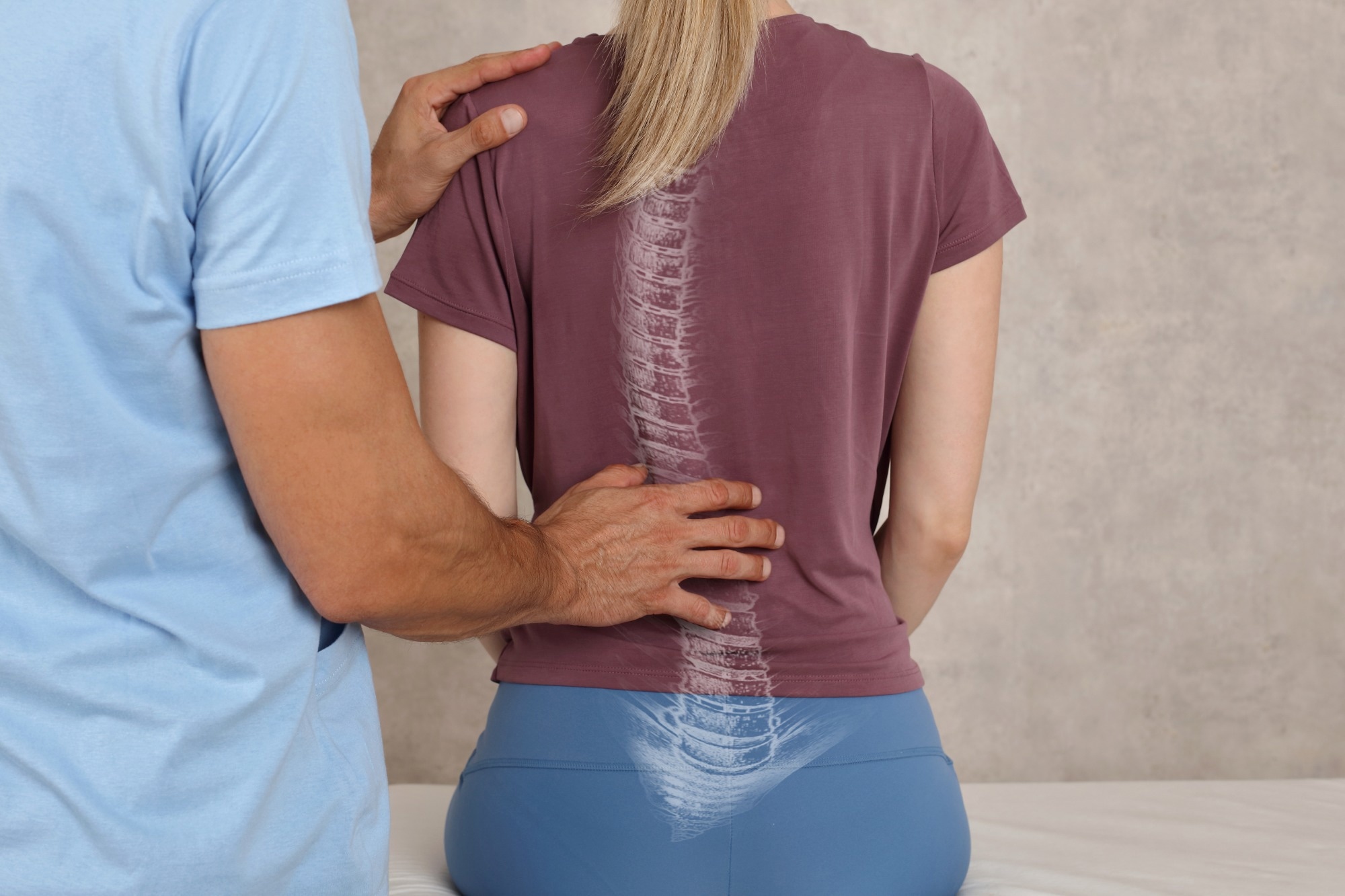 Scoliosis Spine Curve Anatomy, Posture Correction. Chiropractic treatment, Back pain relief.