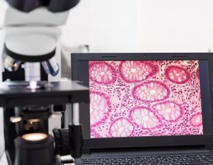 New breakthrough in microscopy and endoscopy may advance the field of precision medicine