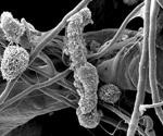 Structure of phycobilisomes of cyanobacterium revealed